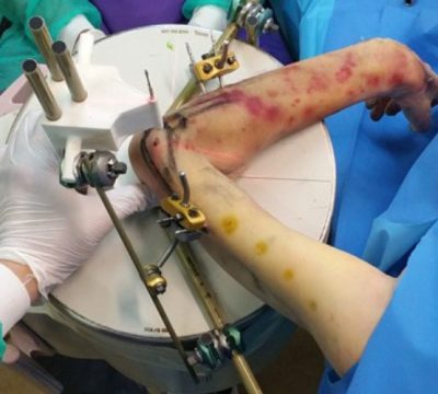 The Growing Impact and Benefits of 3D Printing -Video