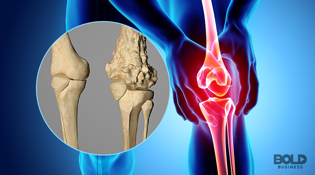 osteosarcoma treatment