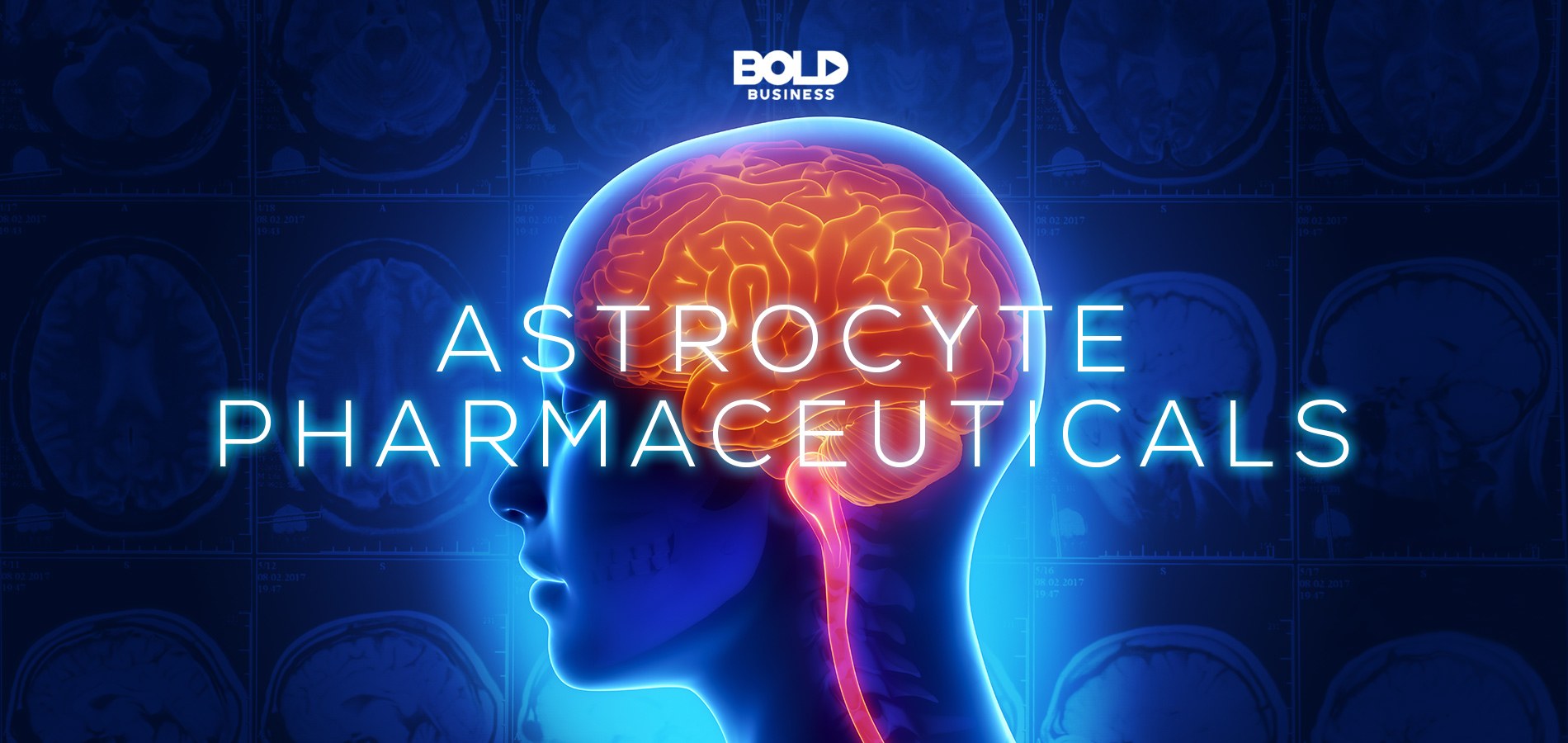 astrocyte pharmaceuticals, 3D image of a brain