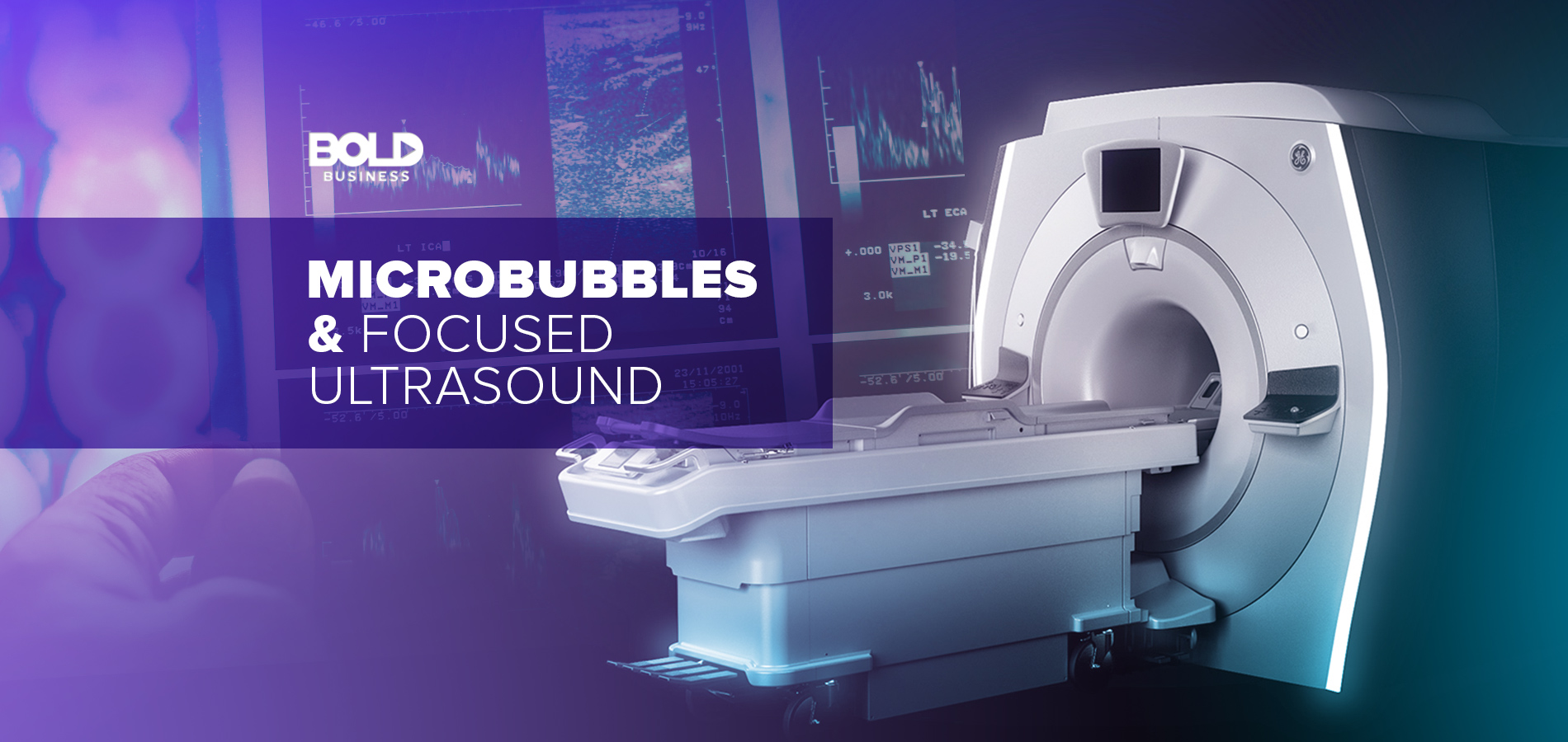 Microbubbles and Focused Ultrasound – Shaking Up Neuromedicine Options for Brain Disease