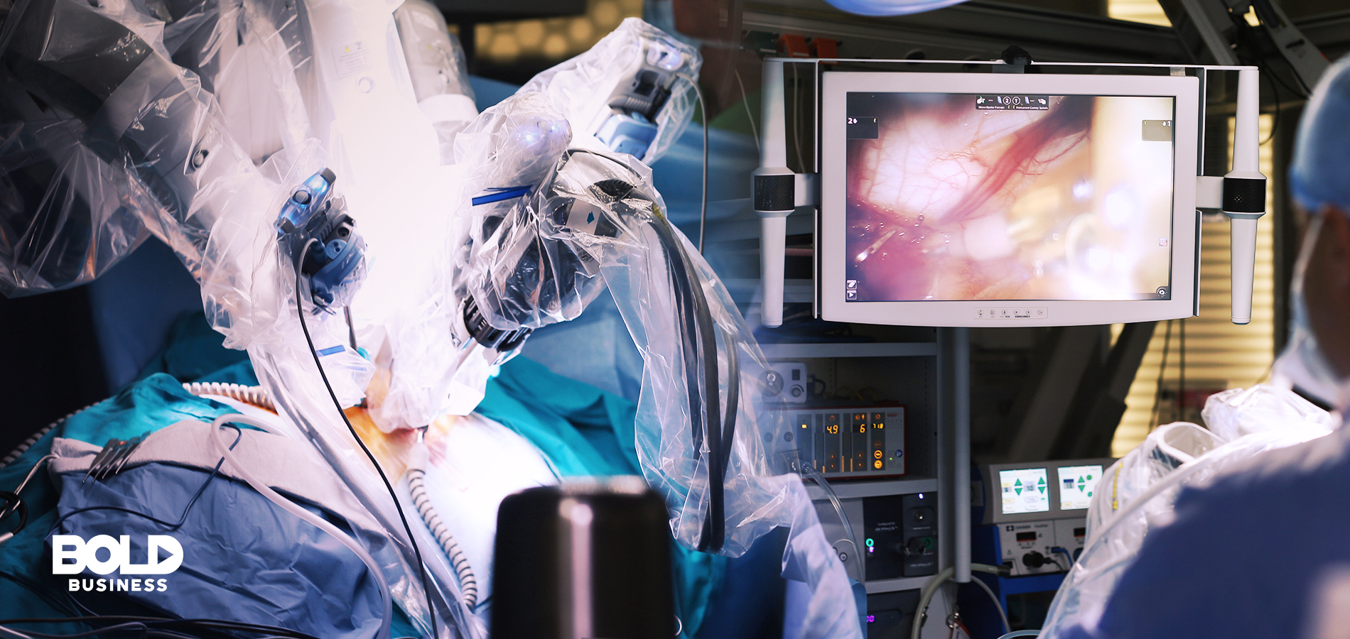 a photo showing a human body being operated on using robotic arms beside a surgeon looking at a screen, thus giving us a picture of what the recent robotic heart surgery looked like