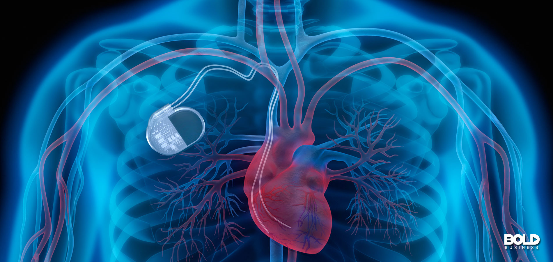 Knowledge From Within: Medical Implant Technology on the Rise