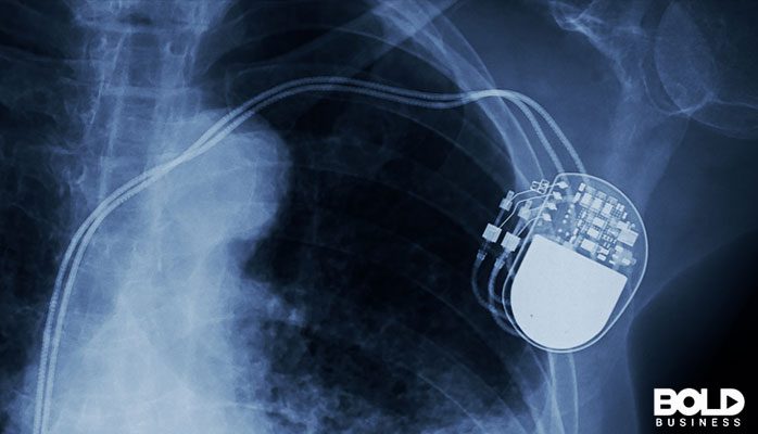 An x-ray of someone with a medical implant
