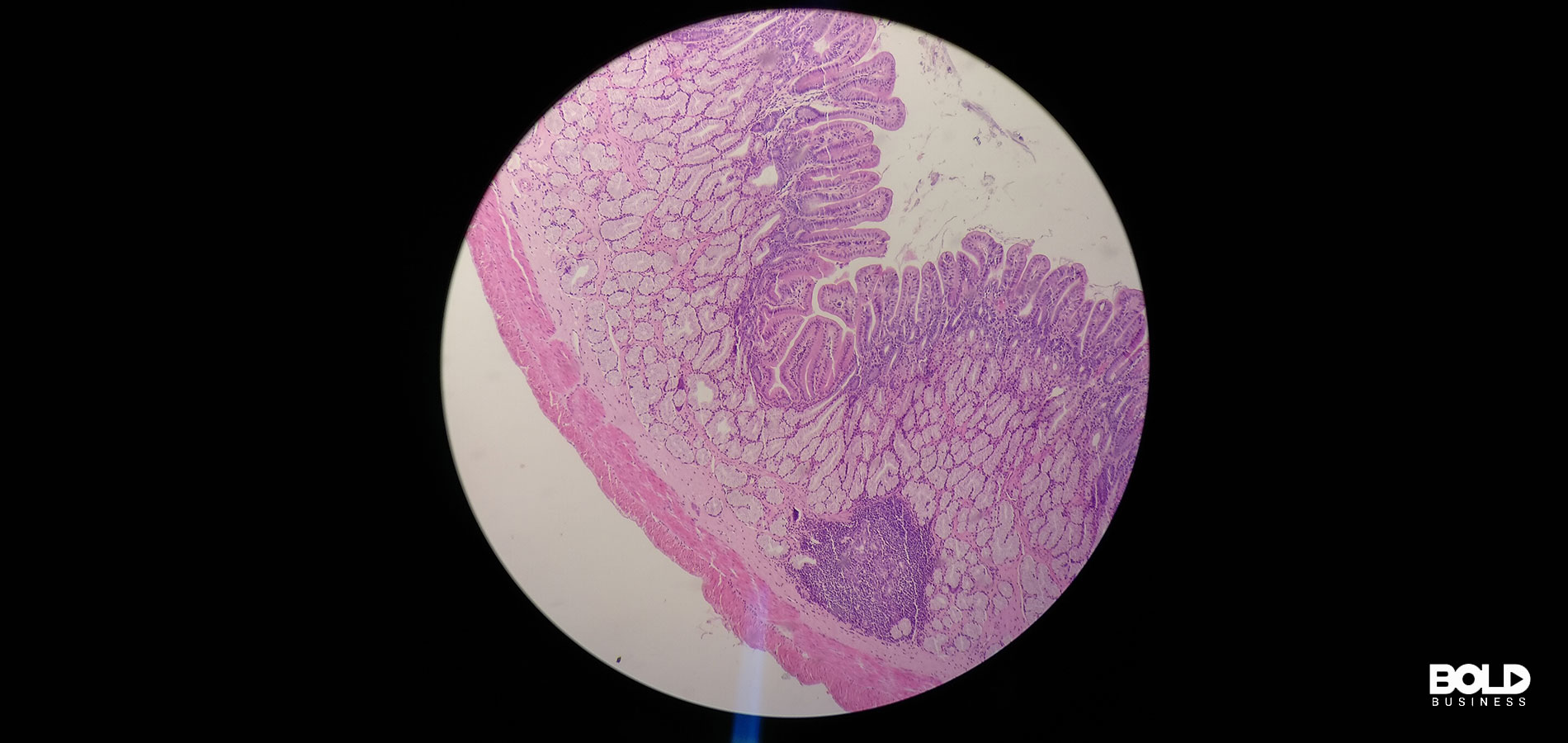 A close up of an enteroendocrine cell