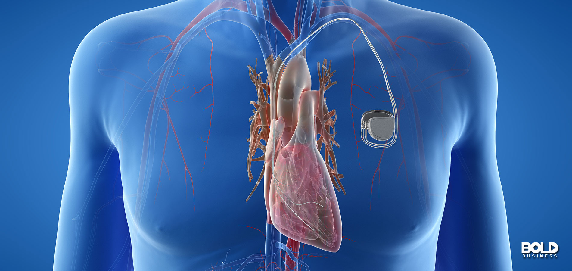 Healing Hearts with an Innovative Bionic Pacemaker