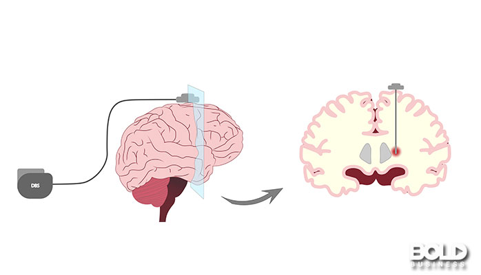 A cartoon of some brains being hooked up to computers