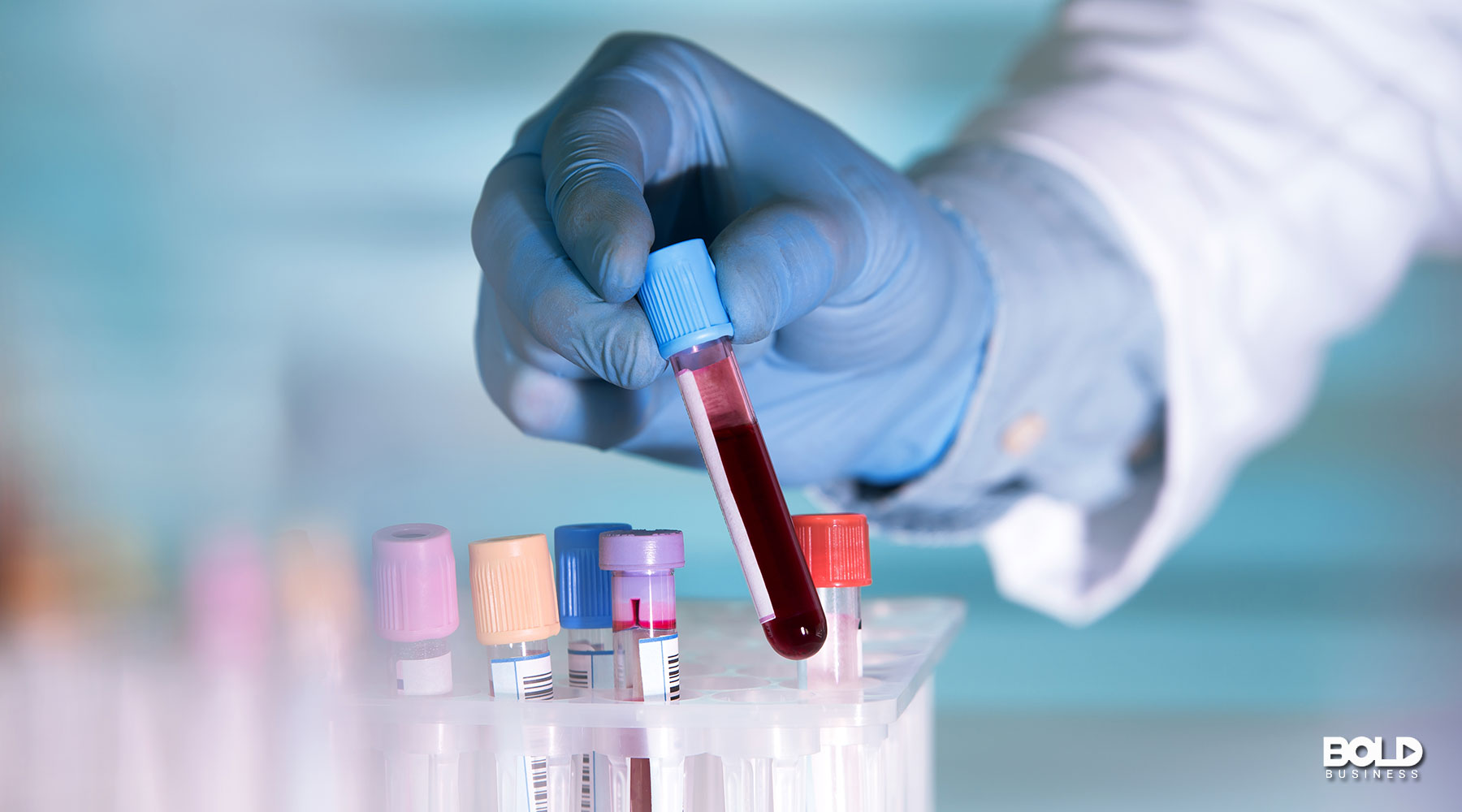 a doctor using blood tests for psychiatric disorders